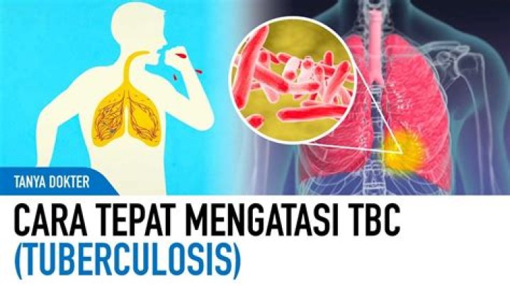 Apakah penyakit TBC bisa sembuh total?