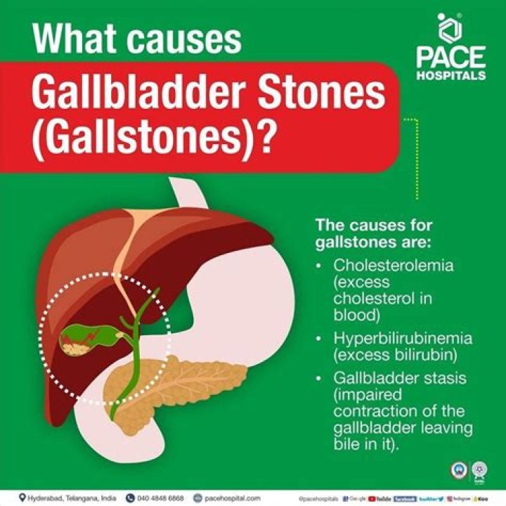 Can just gallstones be removed?