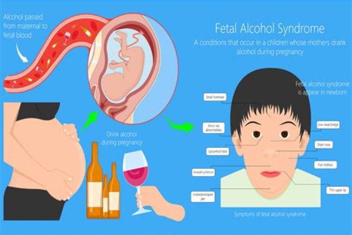 Does alcohol affect sperm during conception?