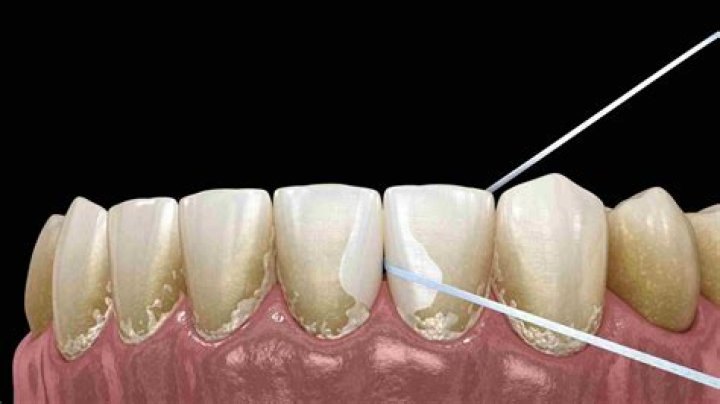 Does dental wax stick to teeth?
