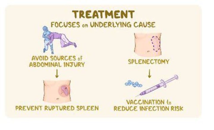 How is splenomegaly treated?