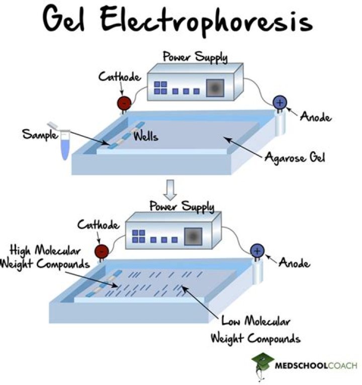 In electrophoresis is anode positive or negative?