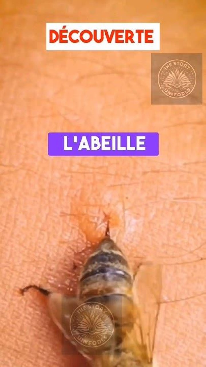 Quand une abeille te pique ?