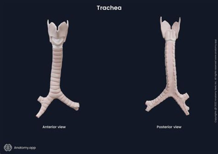 What is trachea midline?