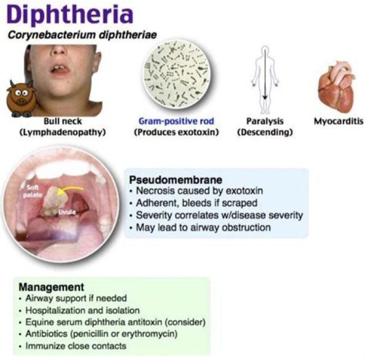 Which germ causes diphtheria?