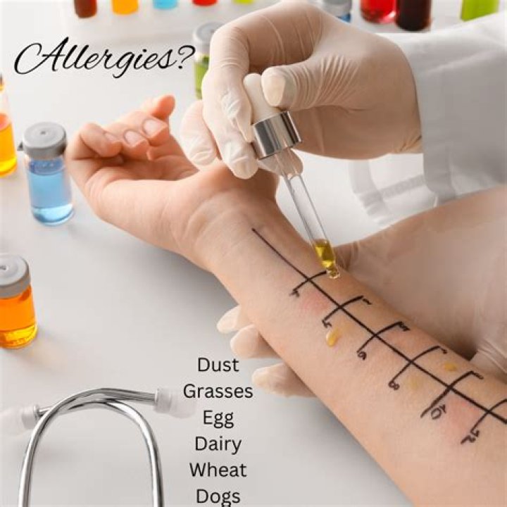 Who test for allergies?