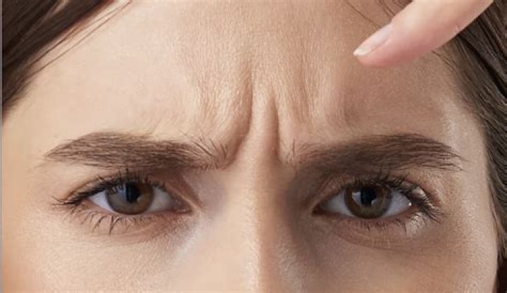 Why do frown lines appear?